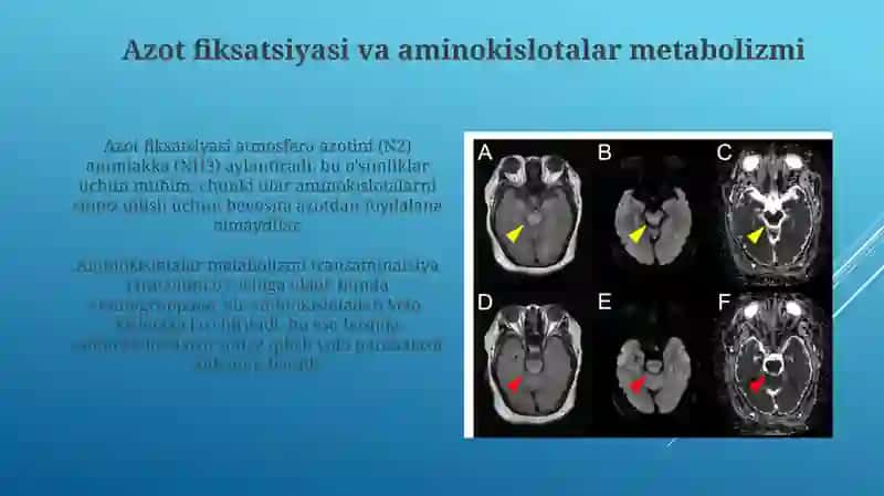 Ammiaknihosilbolishivazararsizlantirishyollari 4