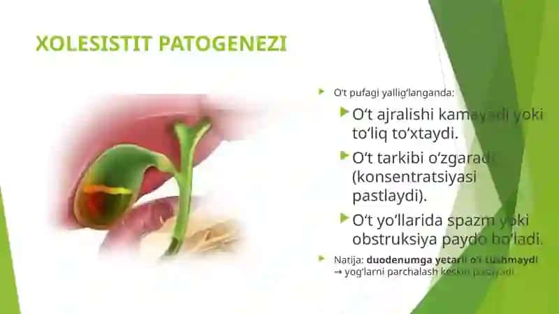 Xolesistitlarda yog'lar hazmlanishining buzilishi (Steatoreya) 4
