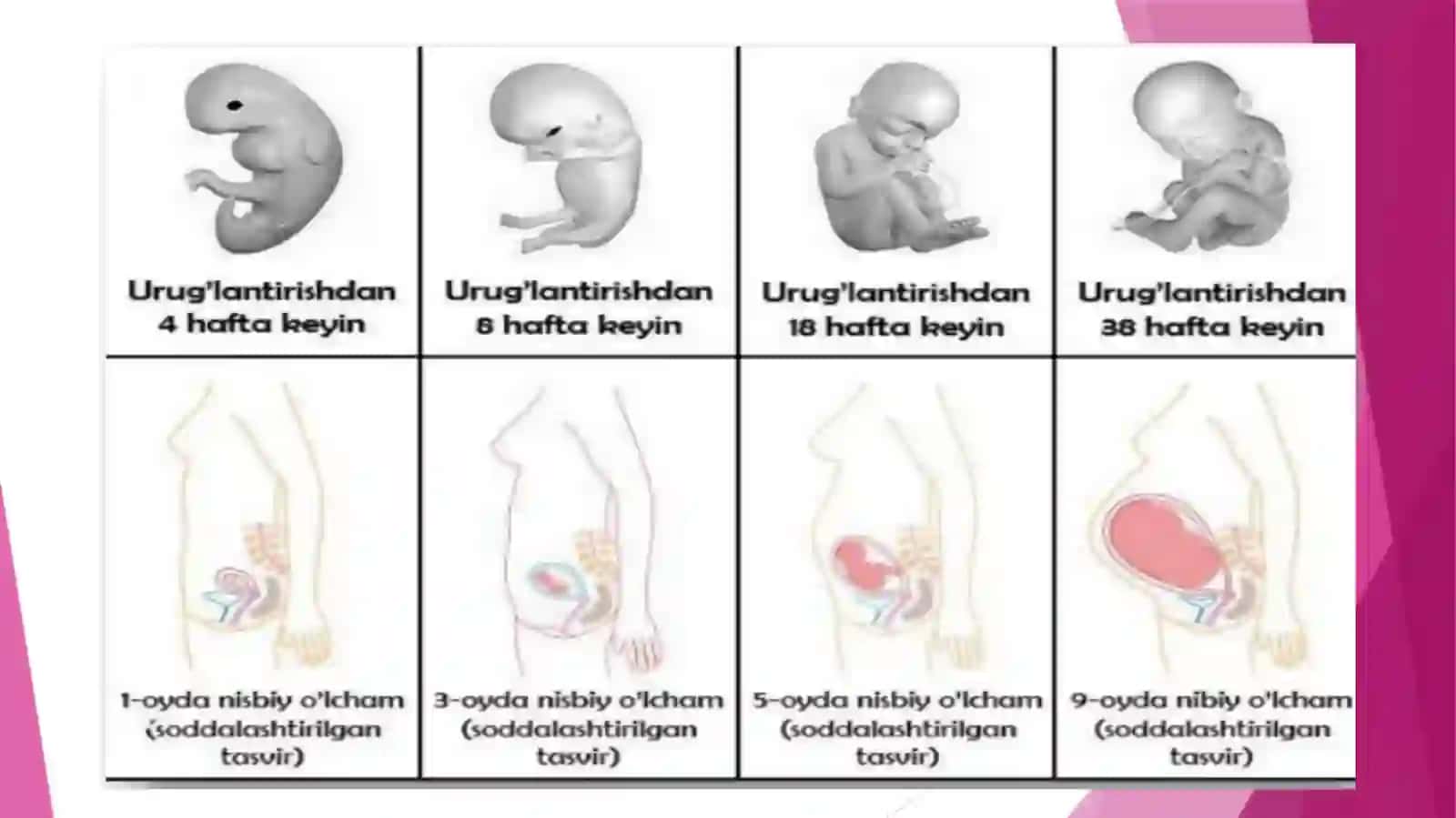 Ona qornida rivojlanish patologiyasi 4
