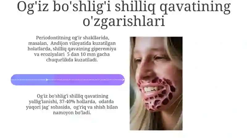 Odontogen sepsis morfologik ko’rinishlari 4