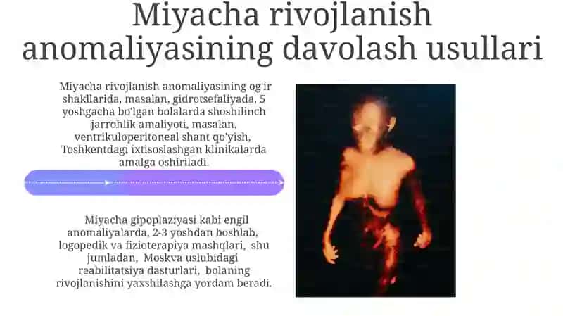 Miyacha Rivojlanish Anomaliyasi 4