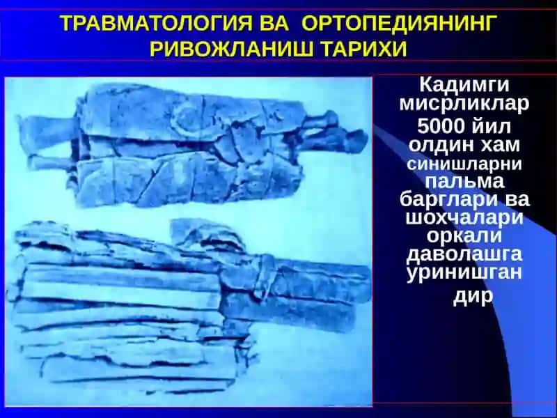 Травматология ва ортопедия 4