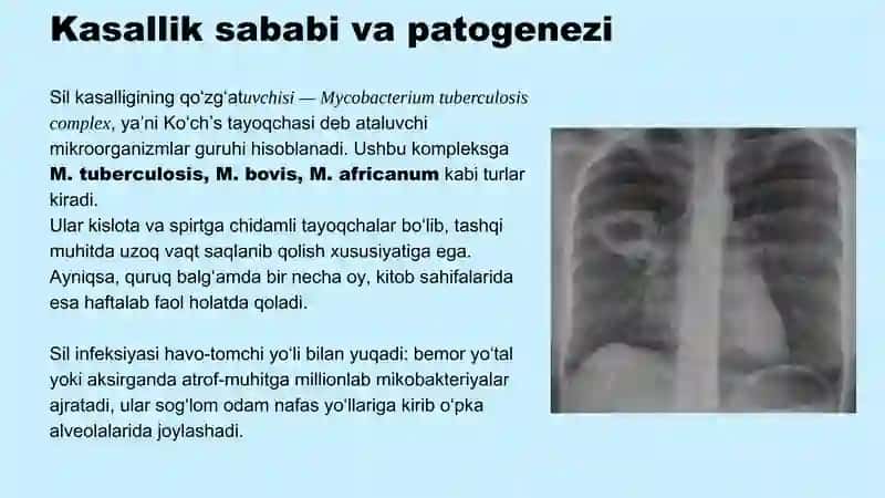 BJSST standartlariga asosan MDR va XDR-TBni davolash 4
