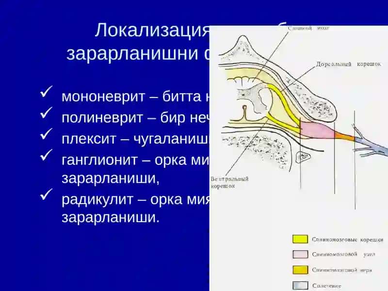 НЕРВ СИСТЕМАСИНГ ПЕРИФЕРИК КАСАЛЛИКЛАРИ 4