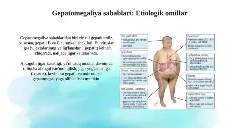 Gepatomegaliya: Ta'rifi va ahamiyati 4