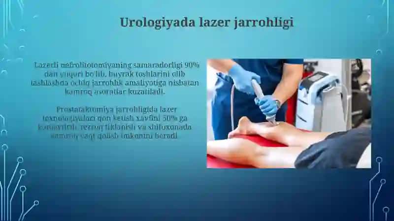 Lazerning tibbiyotda qoʻllanishi 4