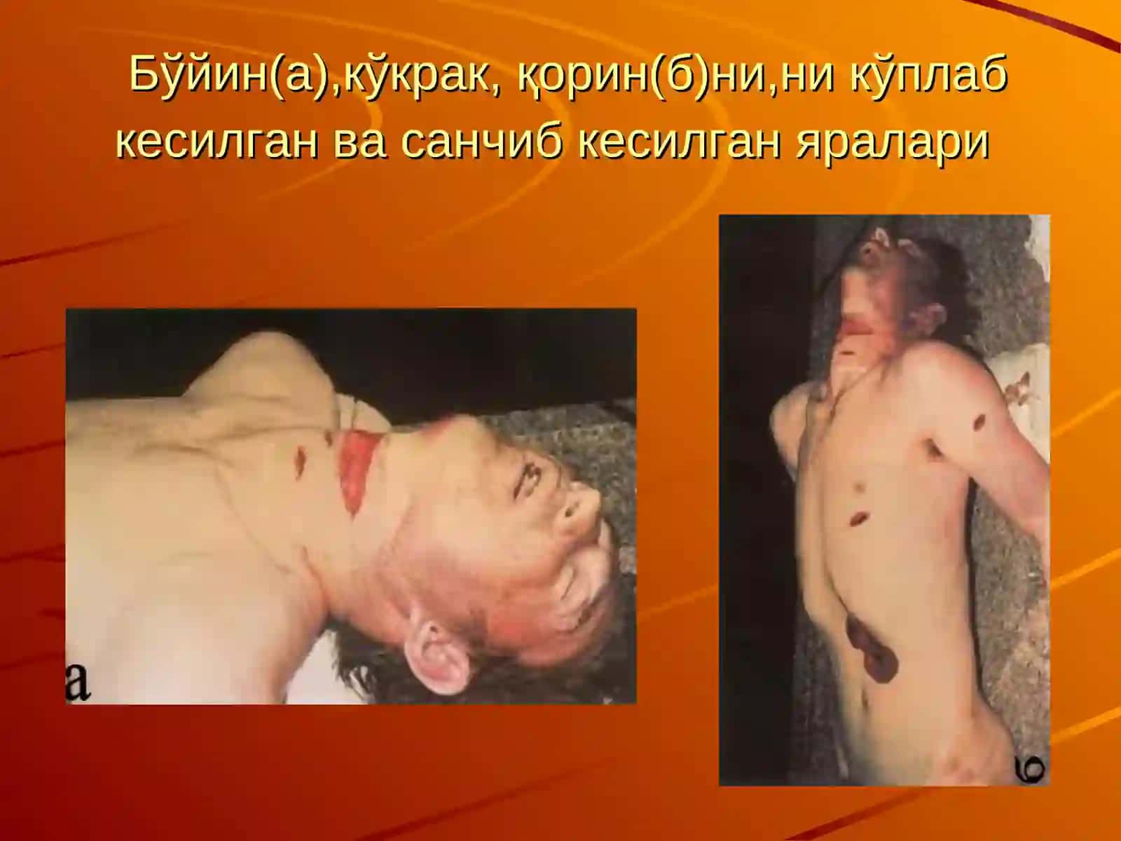 Жароҳатлар суд тиббий таснифи 4
