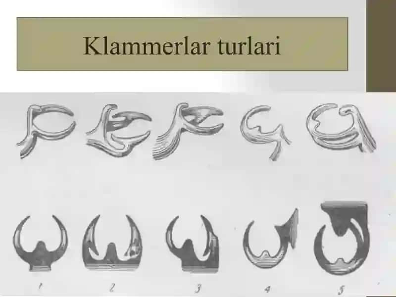 Olinadigan tishprotezlarini tayanch tishlarga tayanib fiksatsiyalash asoslari, klammerlar turlari. 4