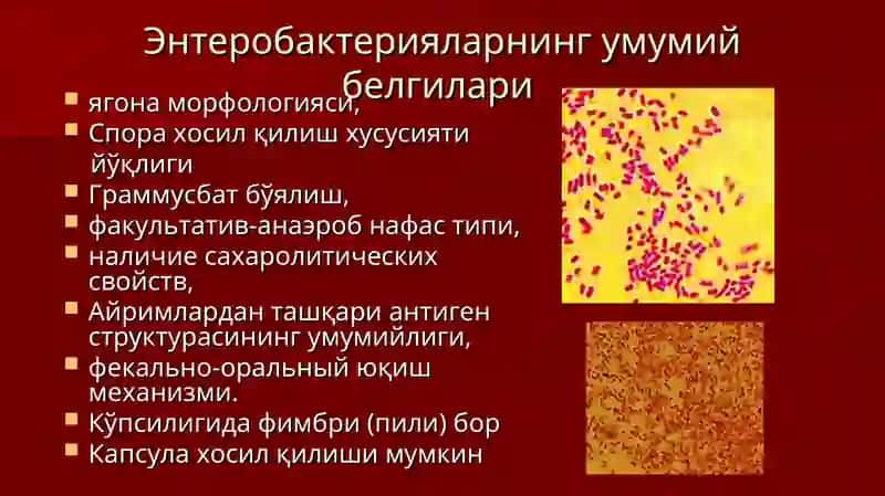 Бактериаличак инфекциялари қўзғатувчилари 4