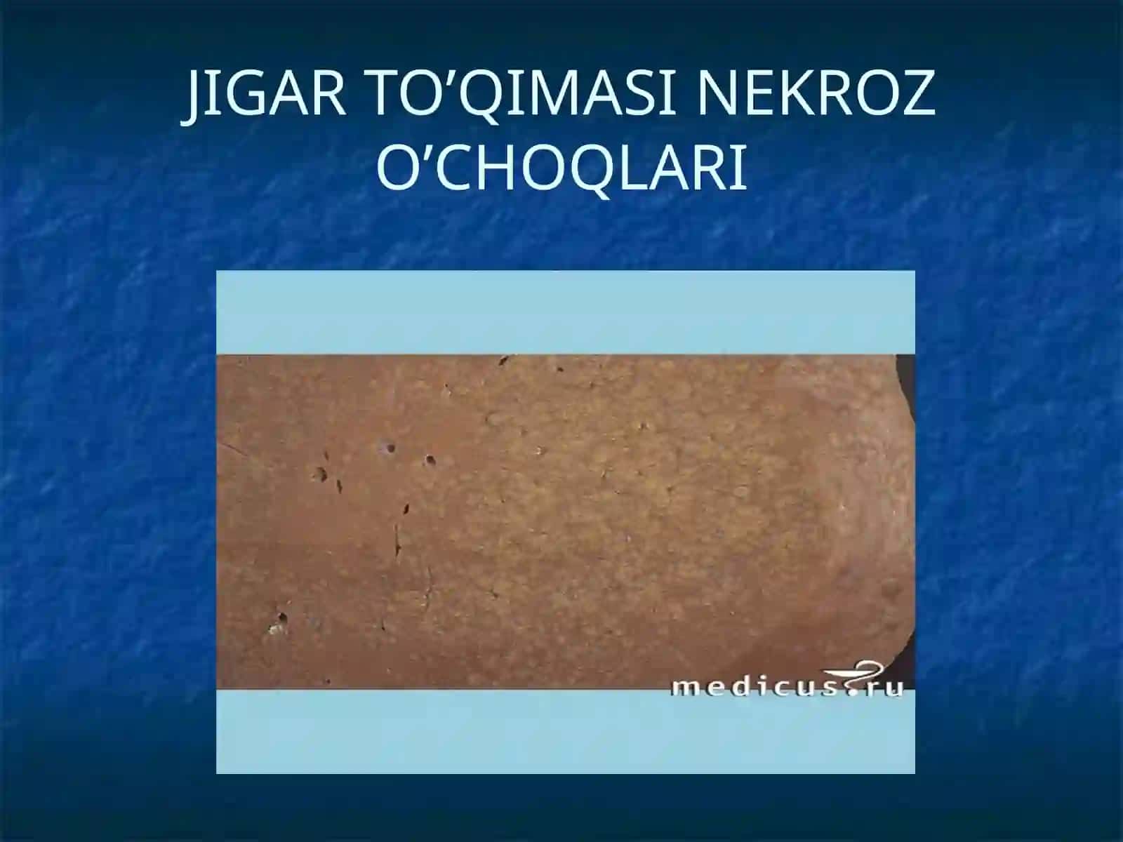 JIGAR SIRROZI 4