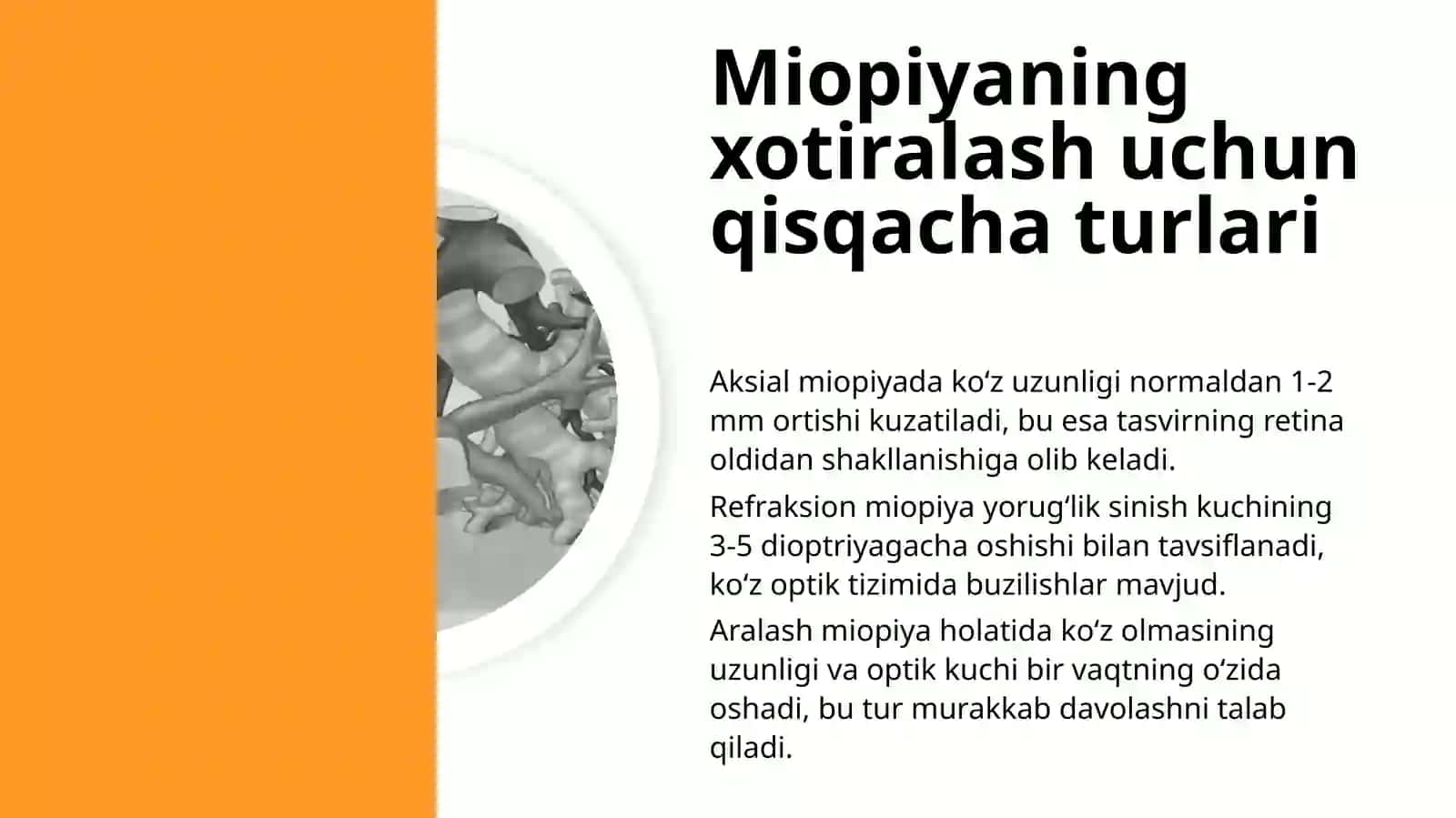 Rivojlanib boruvchi miopiyadan nogiron bo‘lib qolishning profilaktiikasi 4