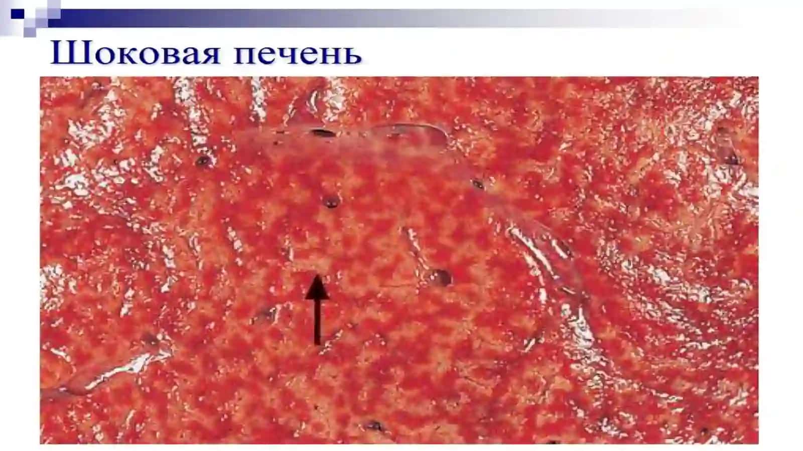 Шок 4