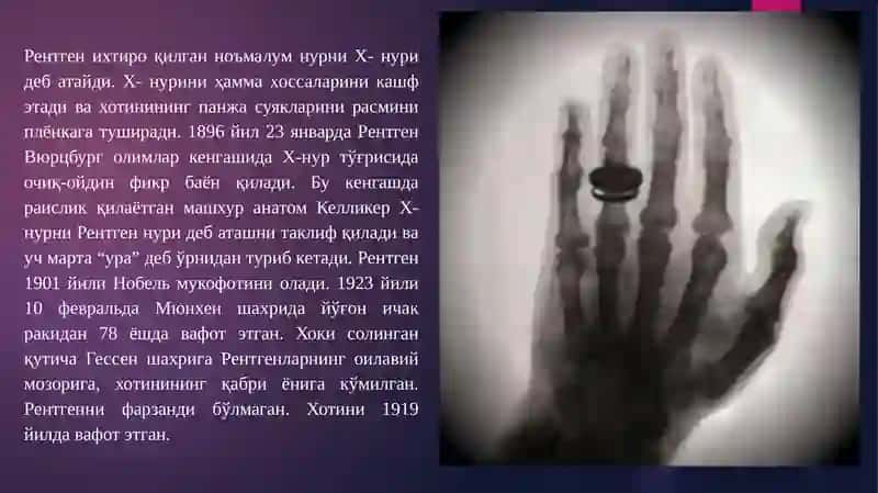 НУР ДИАГНОСТИКАСИ УСУЛЛАРИ, УЛАРНИНГ ФИЗИК ХОССАЛАРИ, КЎРСАТМАЛАР, ҚЎЛЛАНИШ СОҲАЛАРИ, АФЗАЛЛИК ВА КАМЧИЛИКЛАРИ. СУНЪИЙ КОНТРАСТЛАШ. НУР ТЕКШИРИШ НАТИЖАЛАРИНИНГ ТАҲЛИЛИ 4