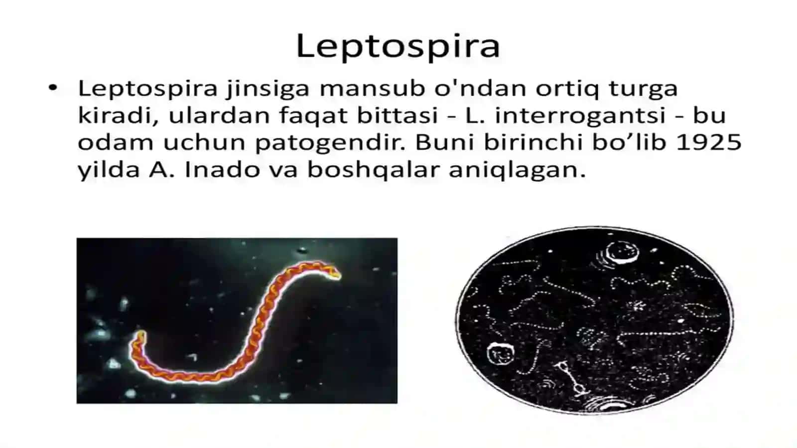 Leptospirozlar morfologiyasi,strukturasi,tarqalganligini keltirib chiqaruvchi kasalliklar labaratoriya diagnostikasi 4