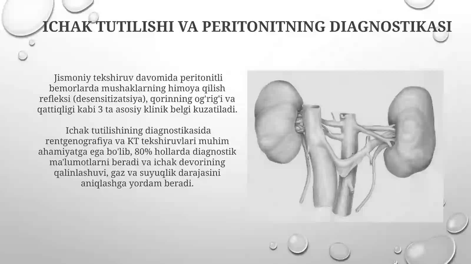 Peritonitning klinik ko'rinishi va davolash usullari 4