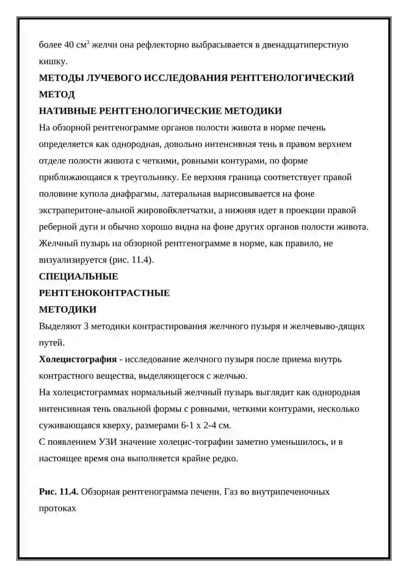 Лучевая диагностика заболеваний печени и желчных протоков 4