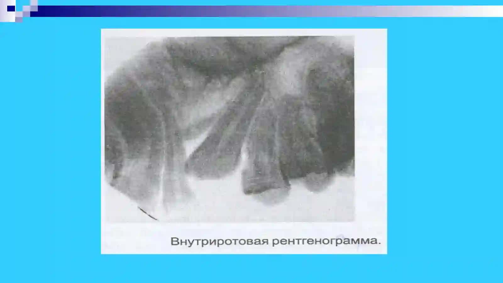 Ортодонтик беморларни махсус текшириш усуллари 4