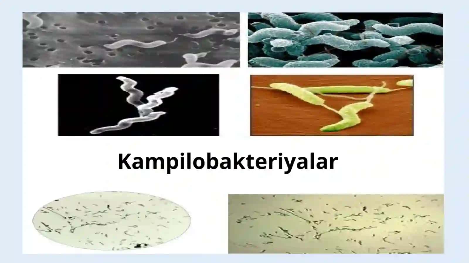 Kampilobakteriyalar, xelikobakteriyalar va ularning amaliyotdagi ahamiyati. Ular keltirib chigargan kasalliklar, laborator tashhisi. 4