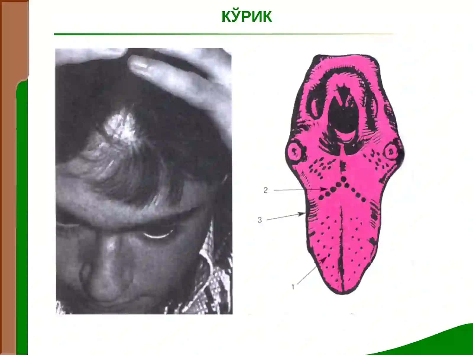 Маъруза № 12 ЖИГАР ВА ЎТ ЙУЛЛАРИ КАСАЛЛИКЛАРИ БИЛАН КАСАЛЛАНГАН БЕМОРЛАРНИ ТЕКШИРИШ. ЖИГАР КАСАЛЛИКЛАРИДАГИ АСОСИЙ СИНДРОМЛАР 4
