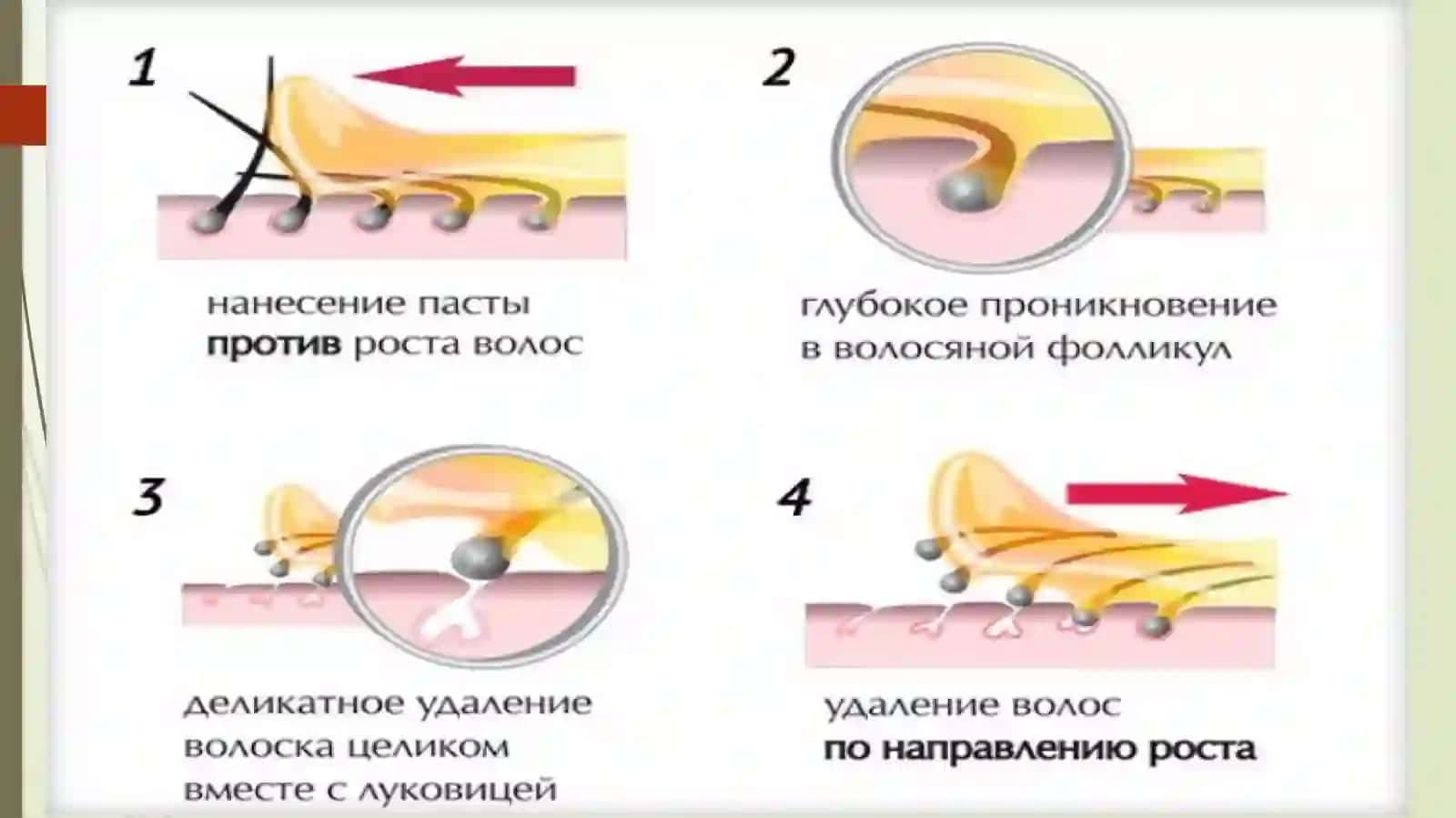 Soch folikulasining gistolotgik tuzilishi 4