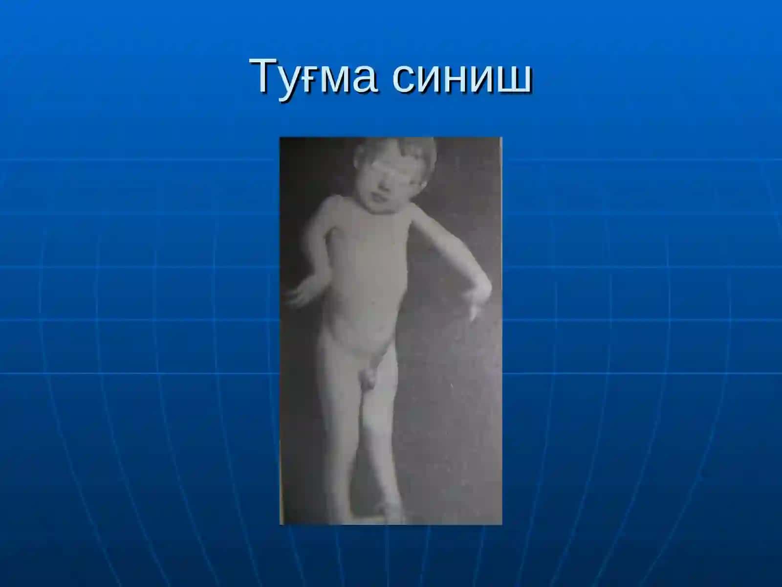 Суякларнинг синиши ва чикиши 4