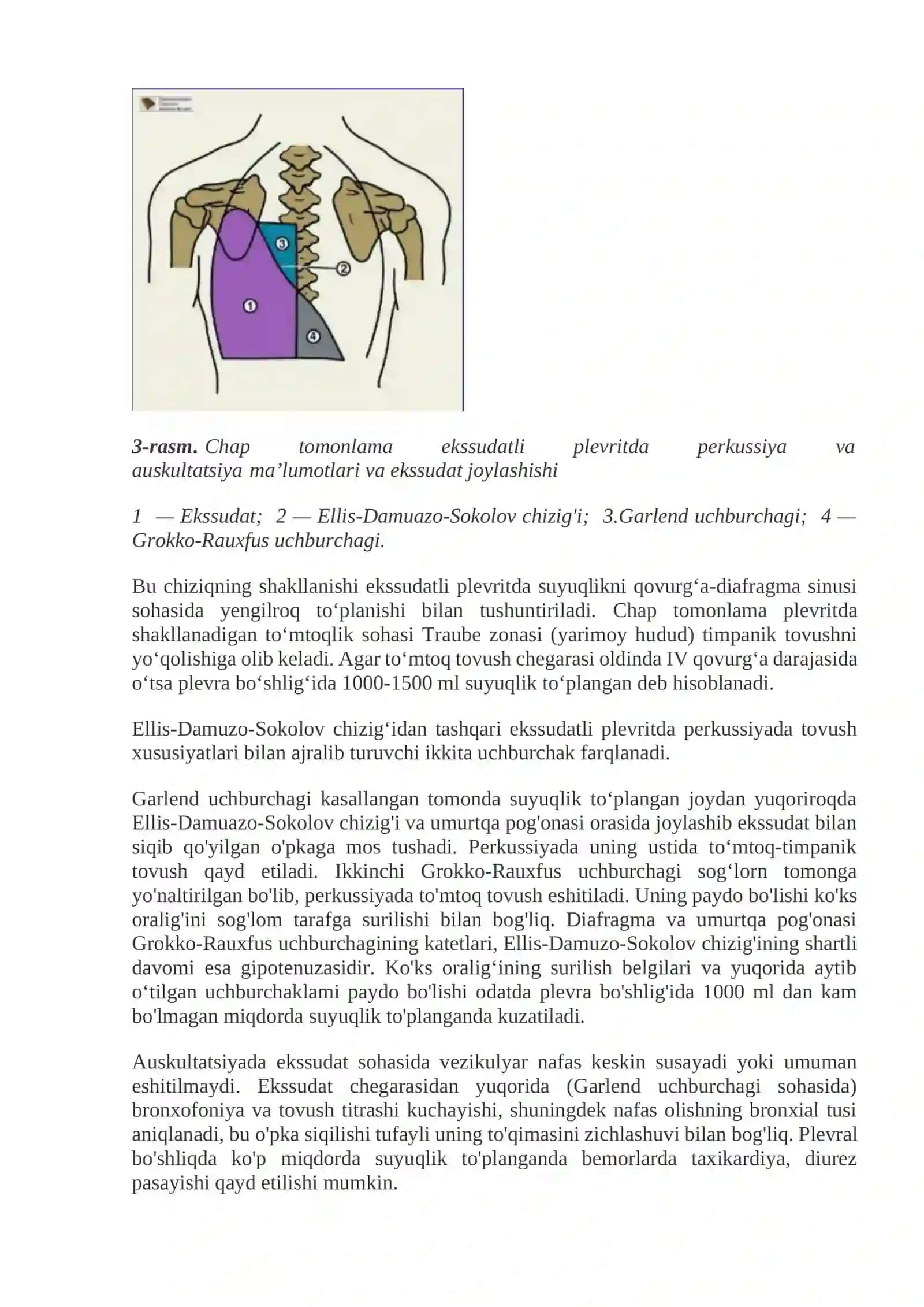 Plevritlar 4