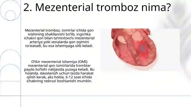 Mezentrial tromboz 4
