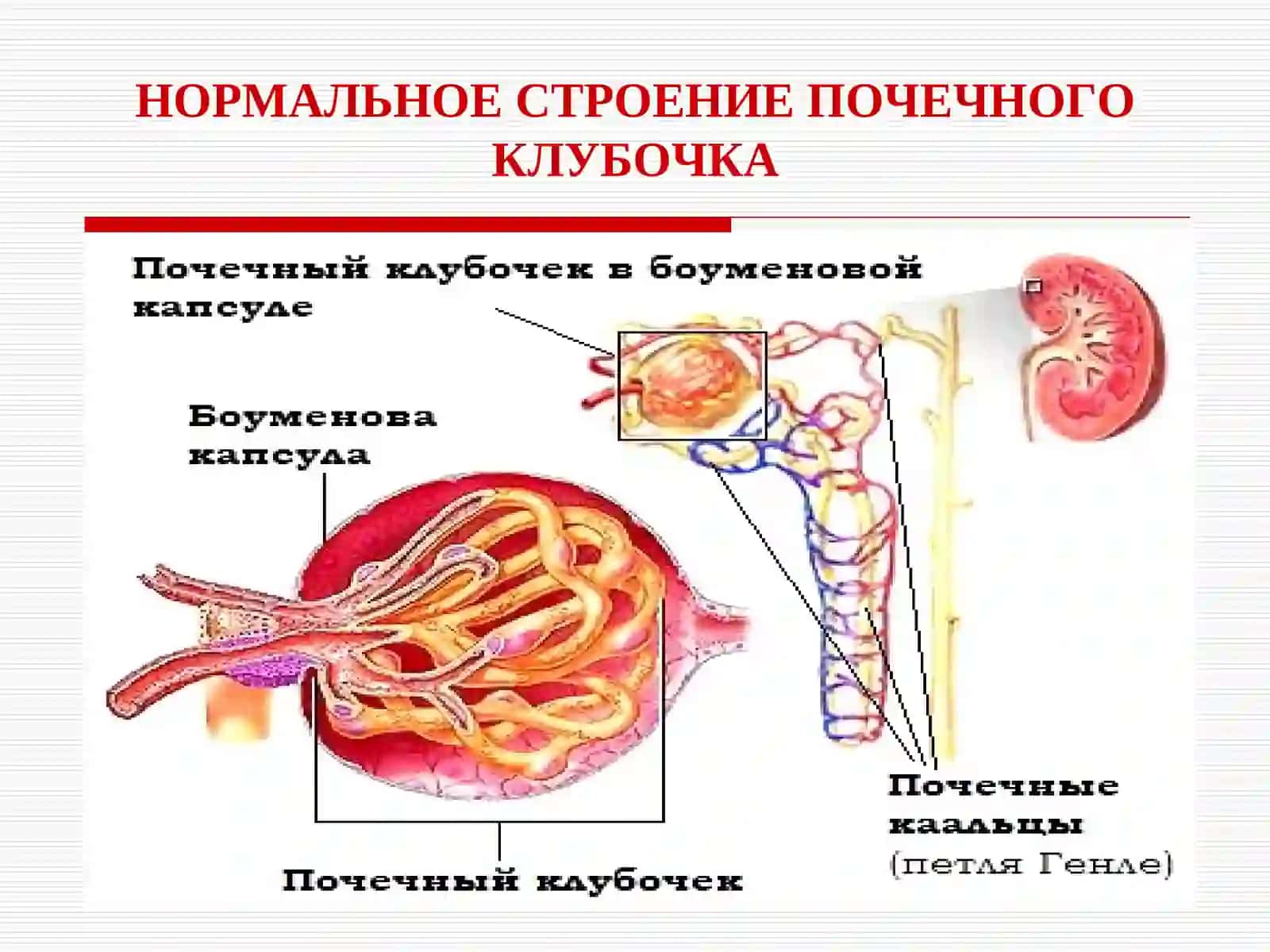 ИНФЕКЦИОННЫЕ ГЛОМЕРУЛОНЕФРИТЫ У ДЕТЕЙ 4