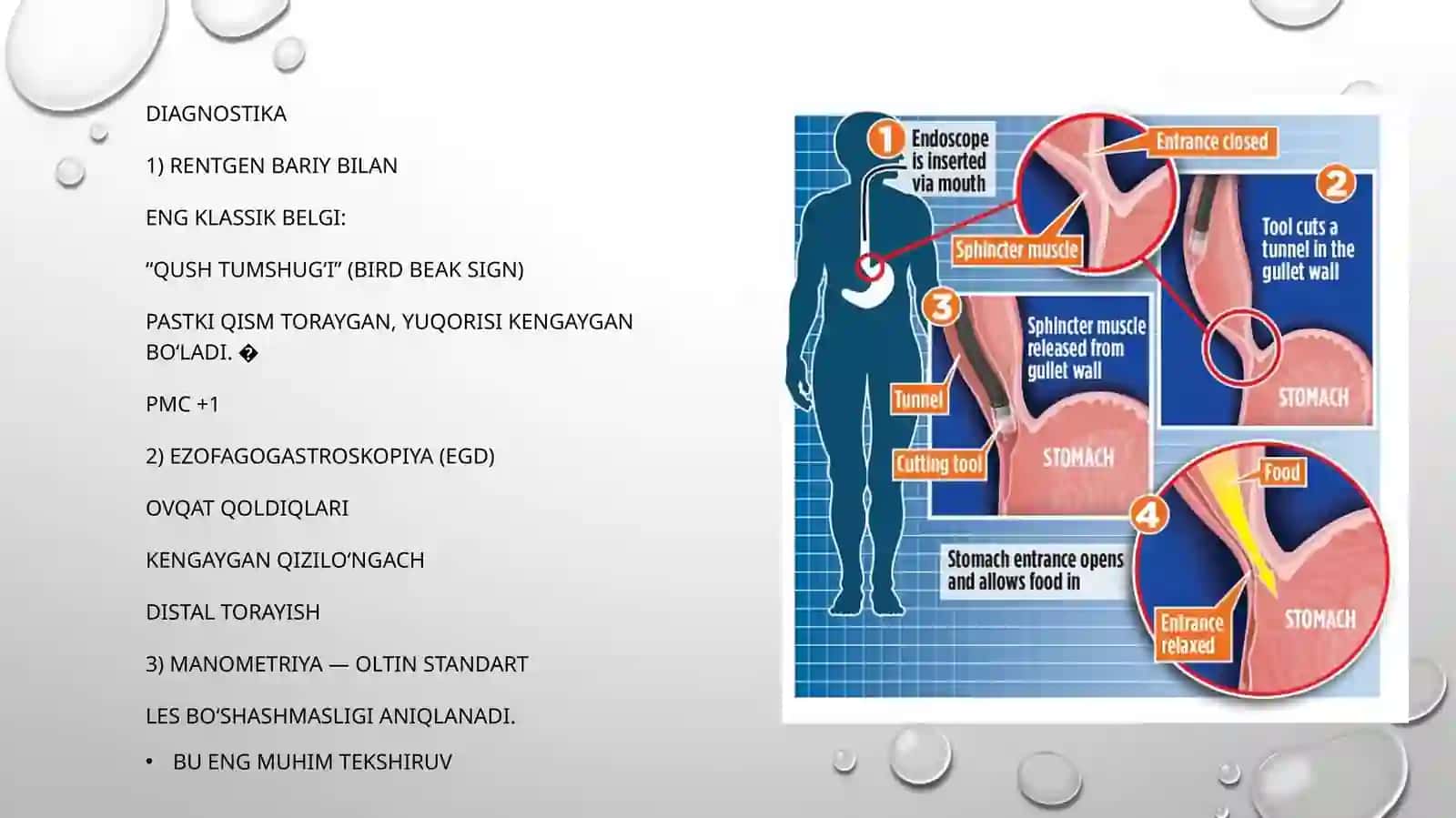 Kardiya axalaziyasi.Gastroezofageal refluks kasalligi.Barret qizilo’ngachi. Oshqozon va o’n ikki barmoqli ichak yara kasalligi asoratlari, diagnostikasi 4