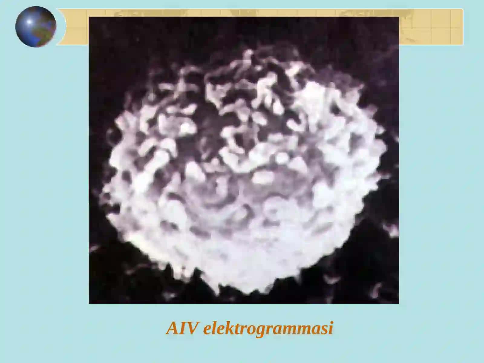 AIV-infekciya/AIJS 4