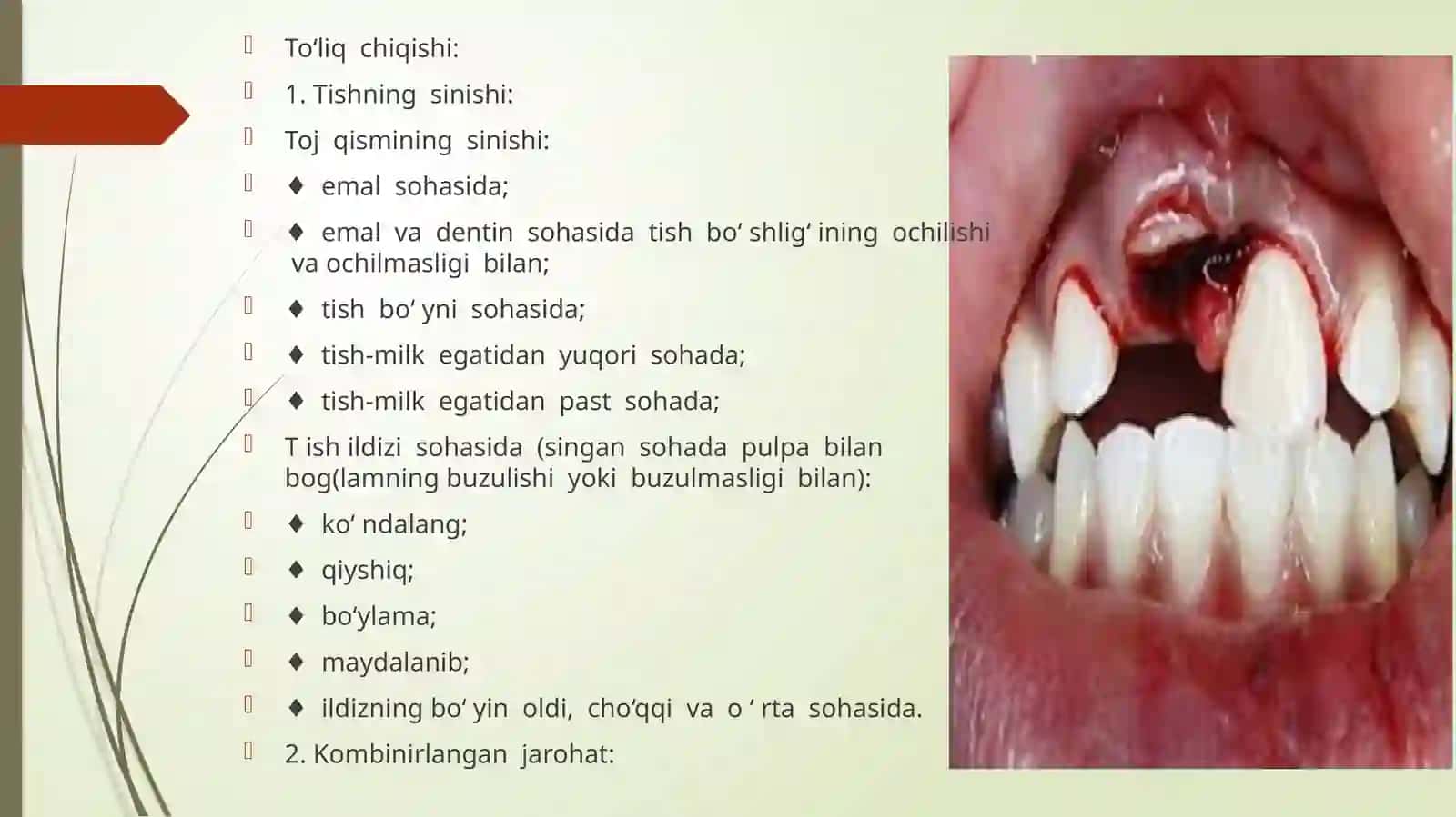 Tish chiqqandan keyin paydo bo'ladigan nokaries kasalliklari 4