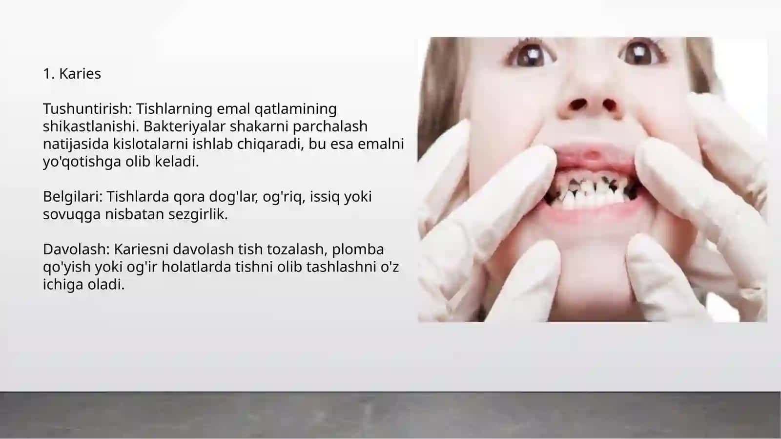 Bolalardagi surunkali infeksiya o'choqlarida og'iz bo'shlig'idagi o'zgarishlar 4
