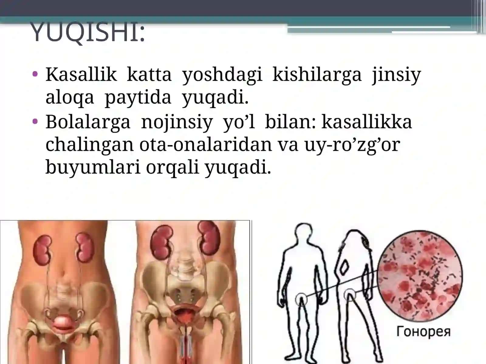 Nospetsifik infeksiya 4
