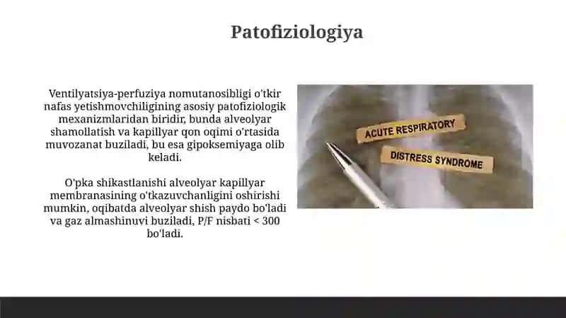 O'tkir nafas yetishmovchiligi 4