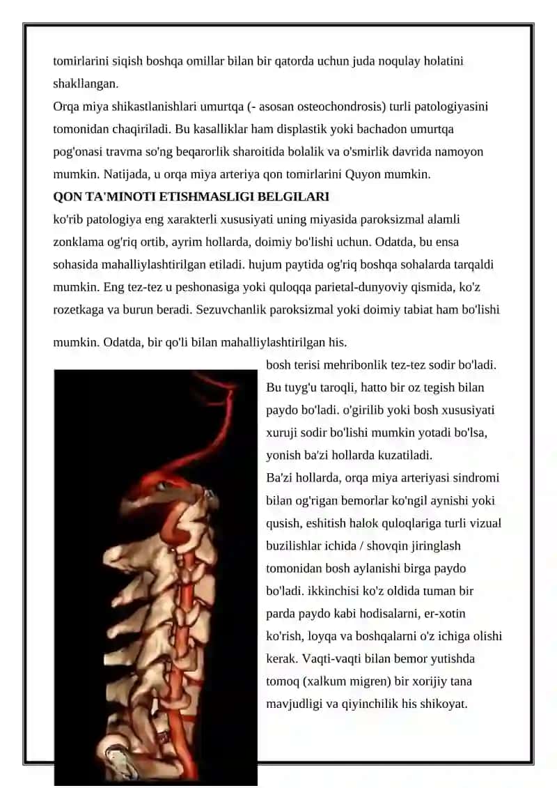 Orqa Miya Arteriyalari. Vertebral Tomir Sindromi: Alomatlar, Tashxis, Davolash 4