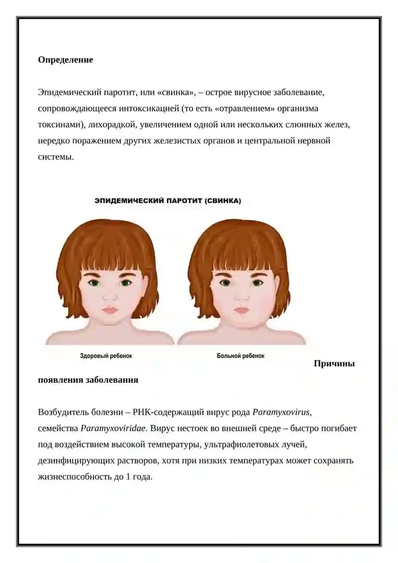Эпидемический паротит 4