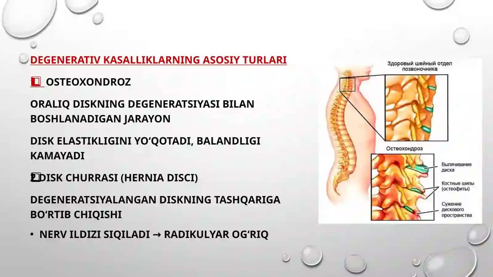 Umurtqapogonasidegenerativkasalliklarini zamonaviyjarroxlikdavolash usullari 4