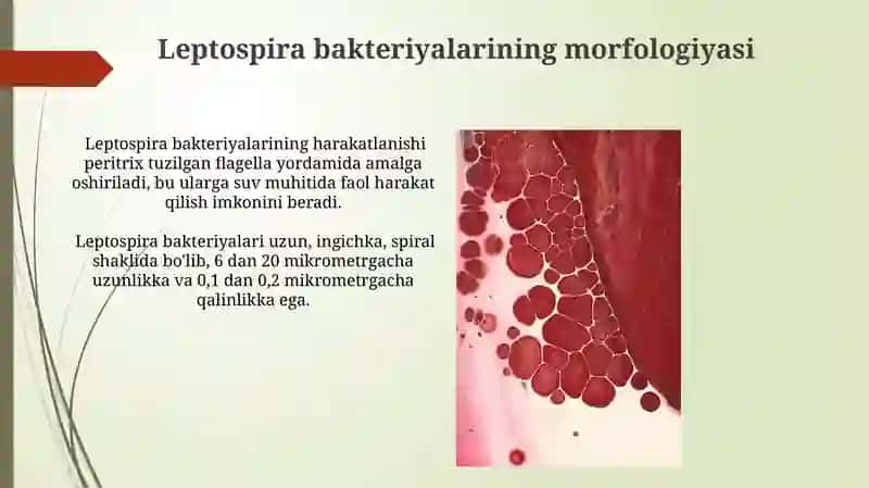 Leptospirozlar morfologiyasi, keltirib chiqaruvchi kasalliklari 4