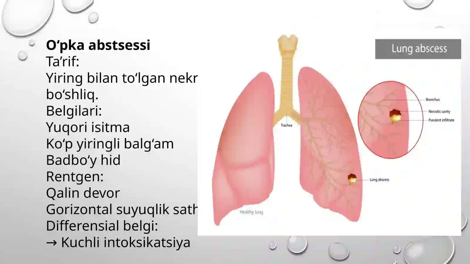 Oʻpka ichidagi boʻshliqlarni qiyosiy tashxislash 4