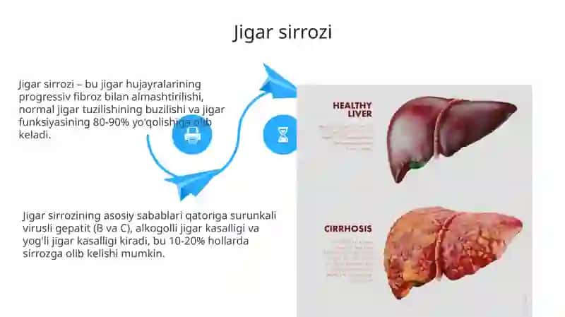 Gepatomegaliya, Jigar sirrozi va Sariqlik: Sabablari, Diagnostikasi va Davolash 4