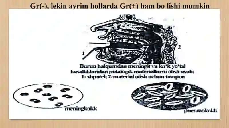 Pnevmokokklar,meningokokklar tavsifi,keltirib chiqaradigan kasalliklar patogenezi., laboratoriya tas 4