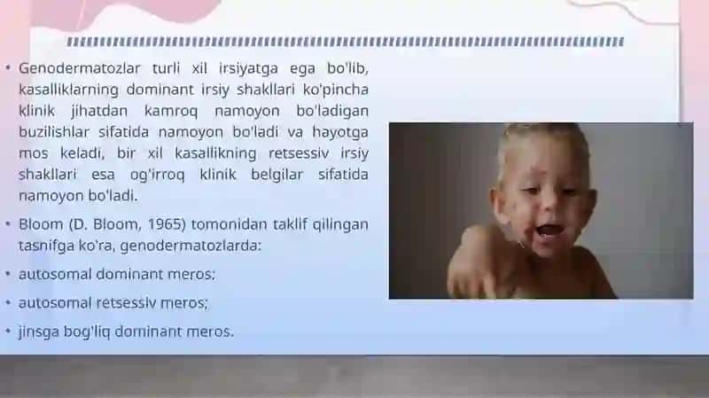 Terining nasliy kasalliklari. Dermatozlar 4