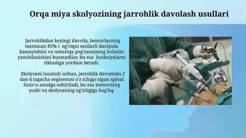 Umurtqa pog'onasi patalogiyalarini operativ davolash usullari 4