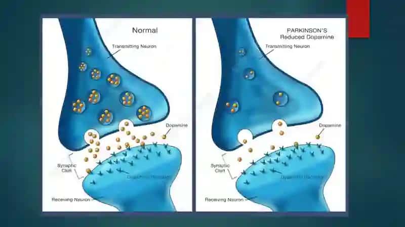 Parkinsonkasalligini davolashda qo’llaniladigan dori vositalari 4
