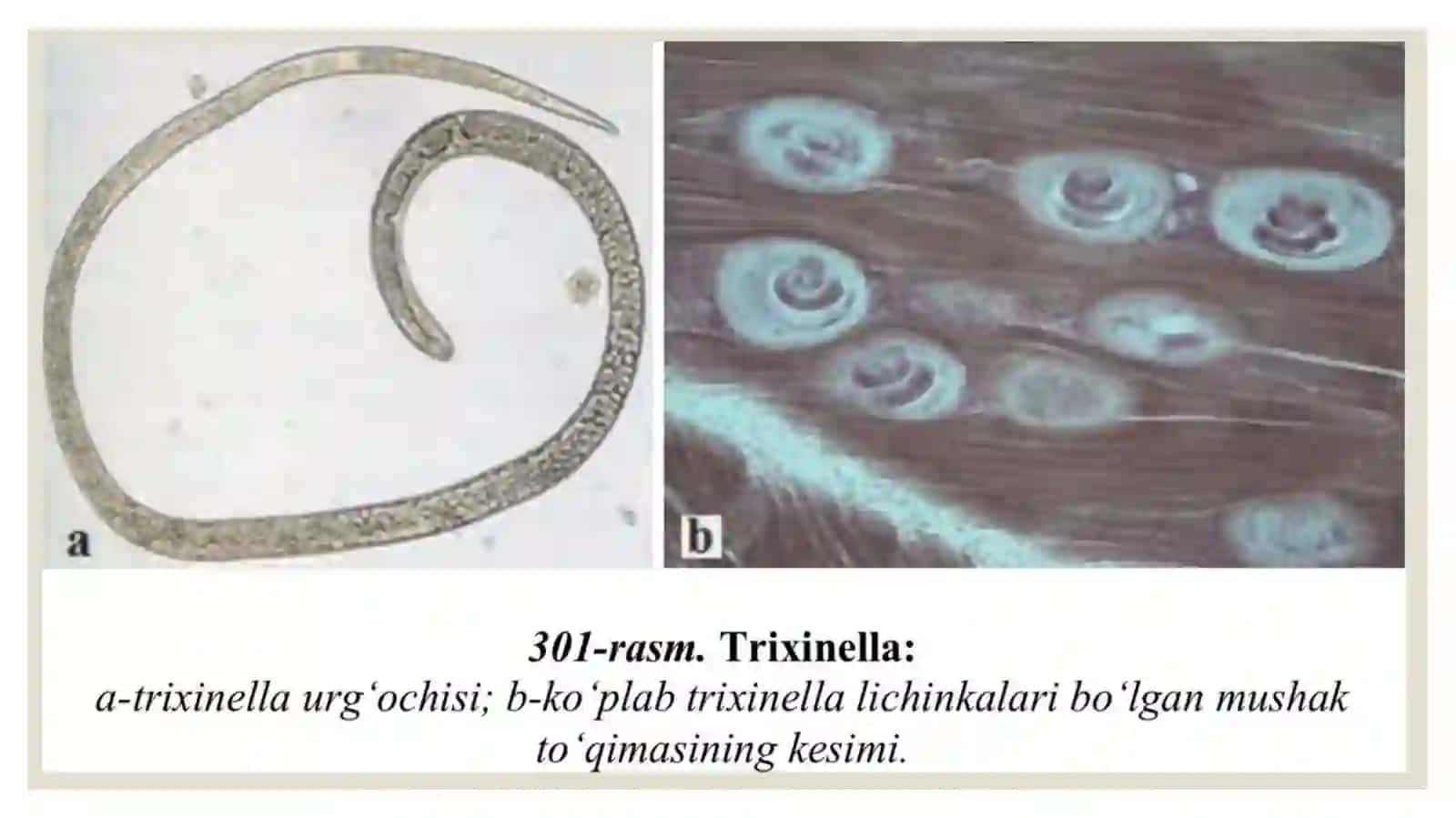 Trixinella(Trichinella spiralis) 4