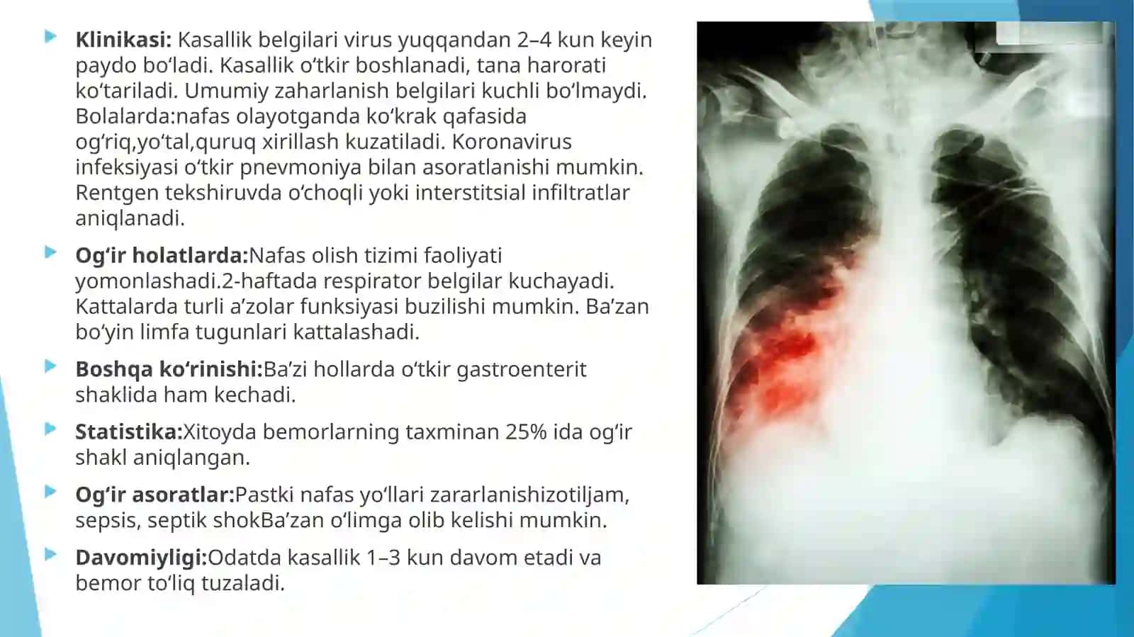 Virusli infeksiyalar 4