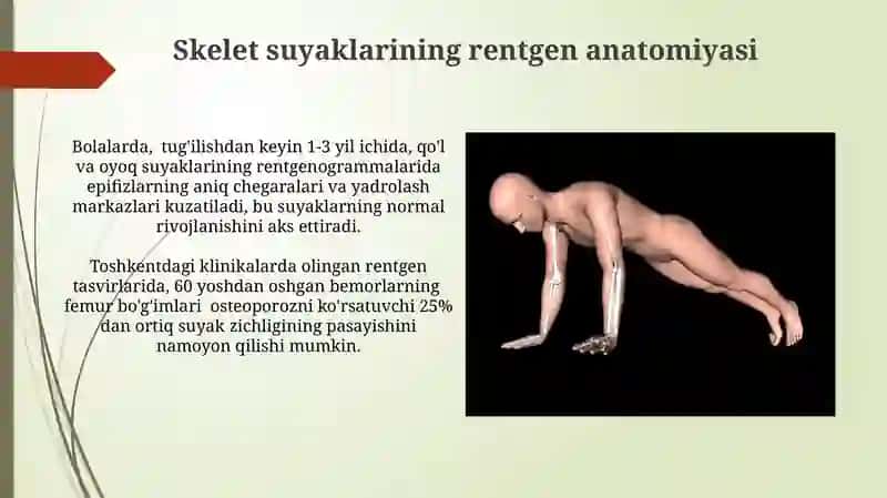 Skelet suyaklarning rentgenanatomiyasi.Skeletni rivojlanish anamiliyasi 4