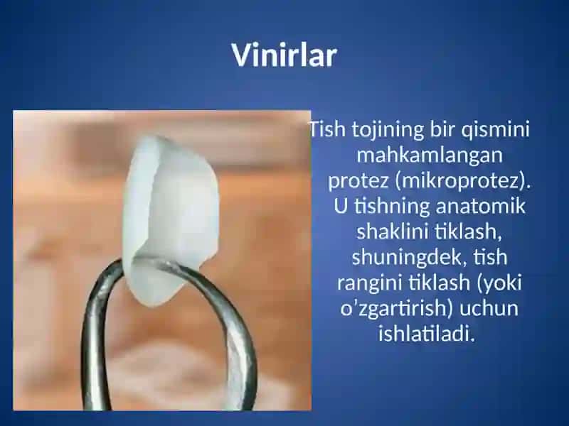 Vinirlarni tayyorlashning zamonaviy usullari 4