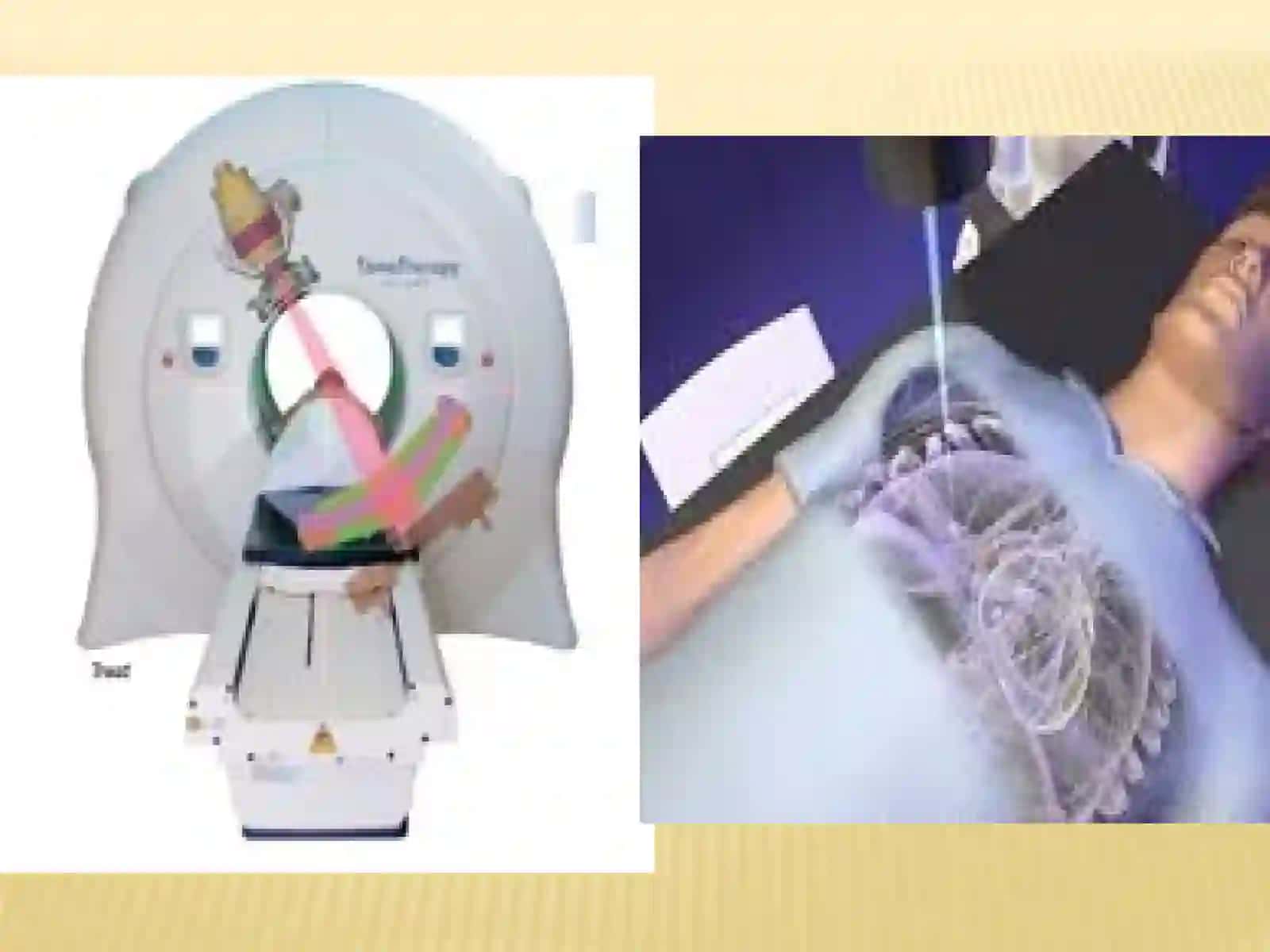 Radiologiya 4
