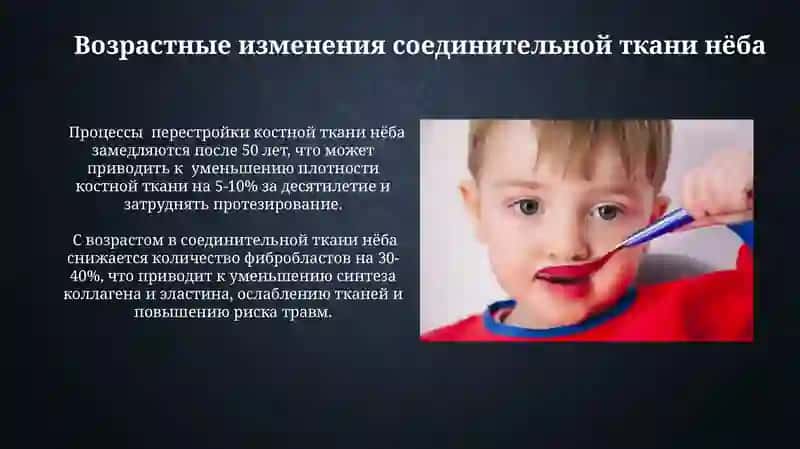 Возрастные особенности неба и его порокиразвития 4